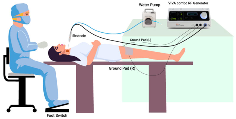 Ultrasound-guided thyroid radiofrequency ablation setup in our office procedure room